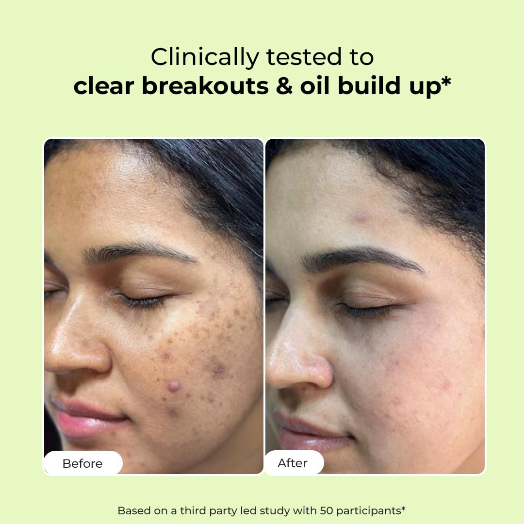 Conscious ChemistÂ® 2% Salicylic Acid Face Wash | 100ml | Face Wash for Oily & Acne Prone Skin for Men & Women, Glycolic Acid & CICA Extract, For Glowing & Radiant Skin, Vegan & Cruelty Free - Flashfix