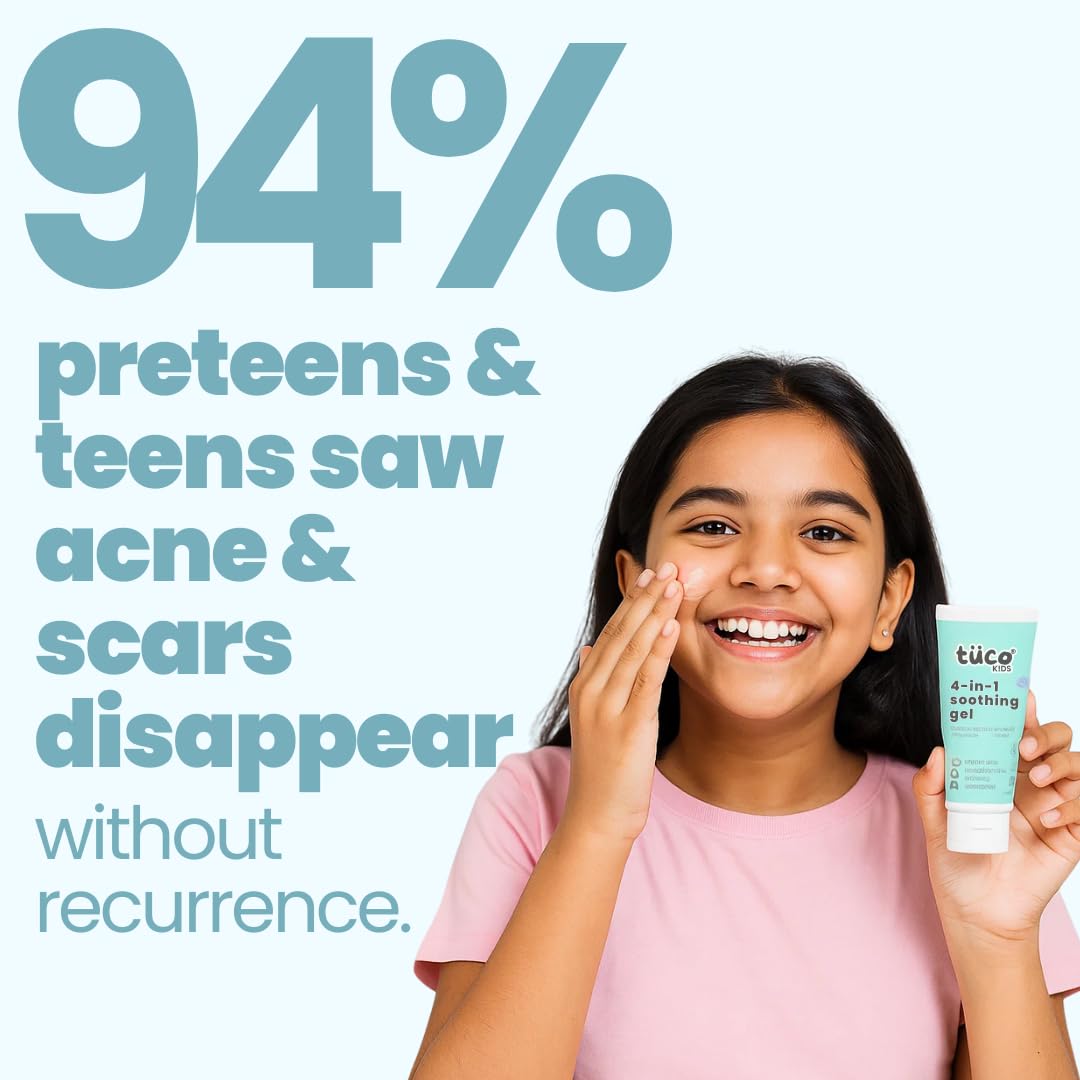 TucoÂ® Anti-Acne Teens Gel Face Cream & Moisturizer | Enriched with Aloe Vera, Tea Tree Oil & Rose Mary | Safe, Hydrates & Soothes Irritated Skin | Used for Dryness & Irritation, Cuts, Sunburn & Bruises | 50 gm