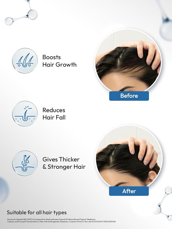 Scalpe Pro Hair Growth Serum - 30 ml