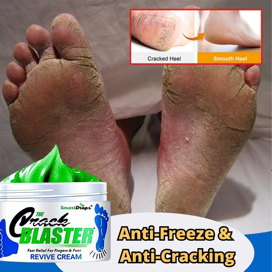 Smartdrops Foot Cream Deeply Moisturizes and Softens Feet & Elbow Skin - 50gm