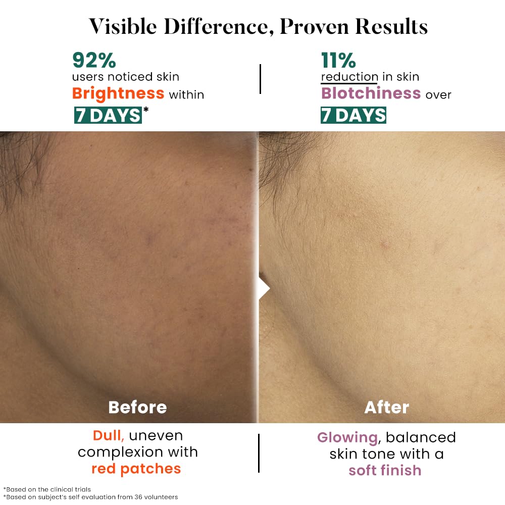 Bio Code 1.5% Alpha Arbutin Brightening Moisturizer (100ml) â€“ with 1% Tranexamic Acid, 1% Licorice & 2% Niacinamide | For Even Tone & Deep Hydration | AI-Enhanced Formula | Dermatologist Recommended