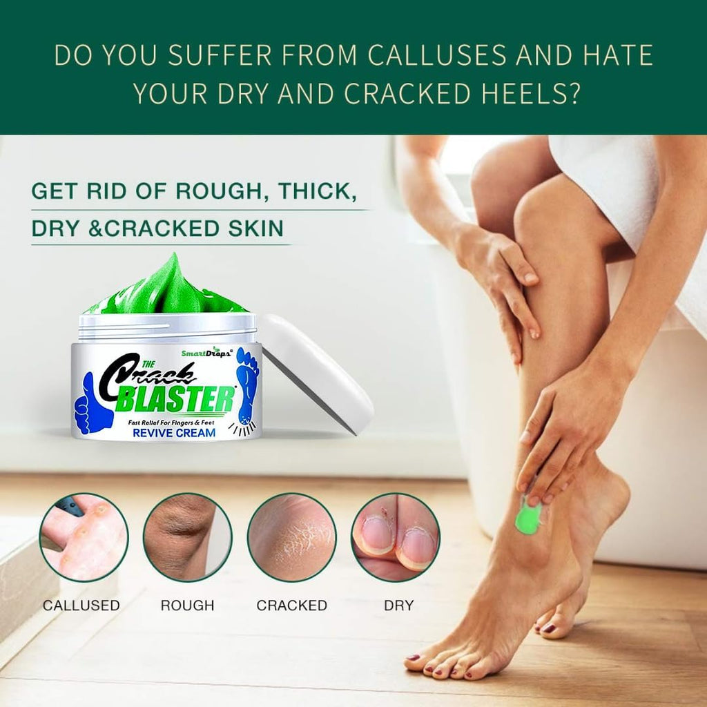 Smartdrops Foot Cream Deeply Moisturizes and Softens Feet & Elbow Skin - 50gm