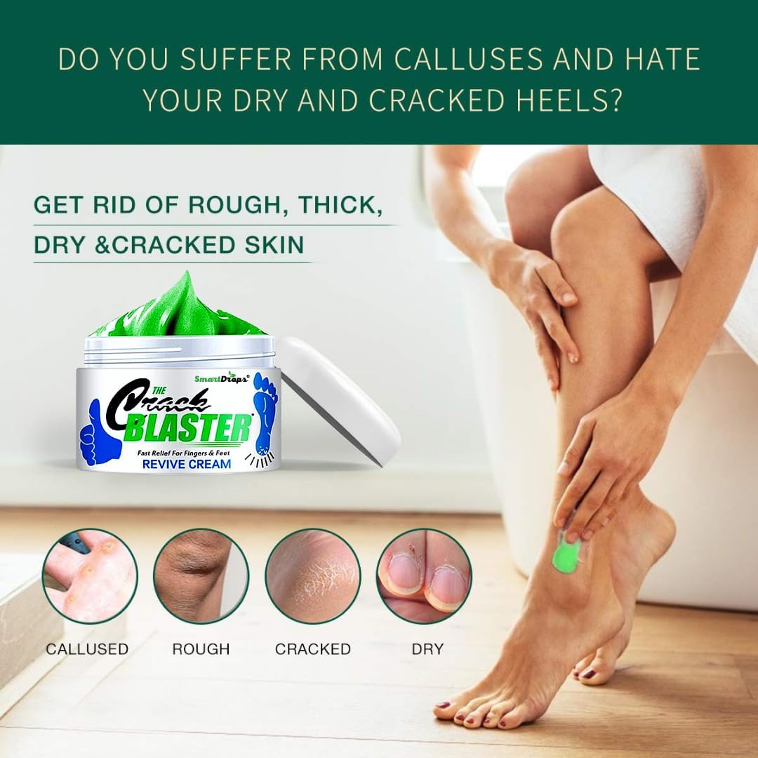 Smartdrops Foot Cream Deeply Moisturizes and Softens Feet & Elbow Skin - 50gm