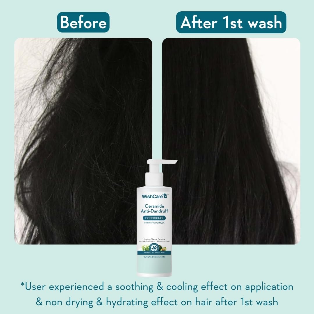 WishCare Ceramide Anti Dandruff Conditioner | Reduces Dandruff & Scalp Itchiness | Conditioner For Dry Hair, Frizzy Hair | With Piroctone Olamine & Hyaluronic Acid | 200ml
