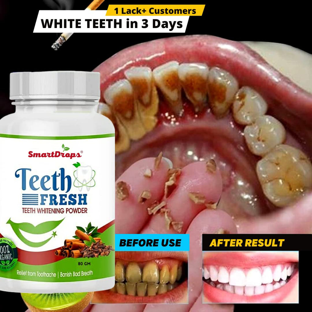 Smartdrops Teeth Whitening Powder, For Shiny Polished Teeth, Improves Teeth Whiteness and Brightness, Helps Fight Plaque, Removes Stains, Freshens Breath, Natural Ingredients, 80gm