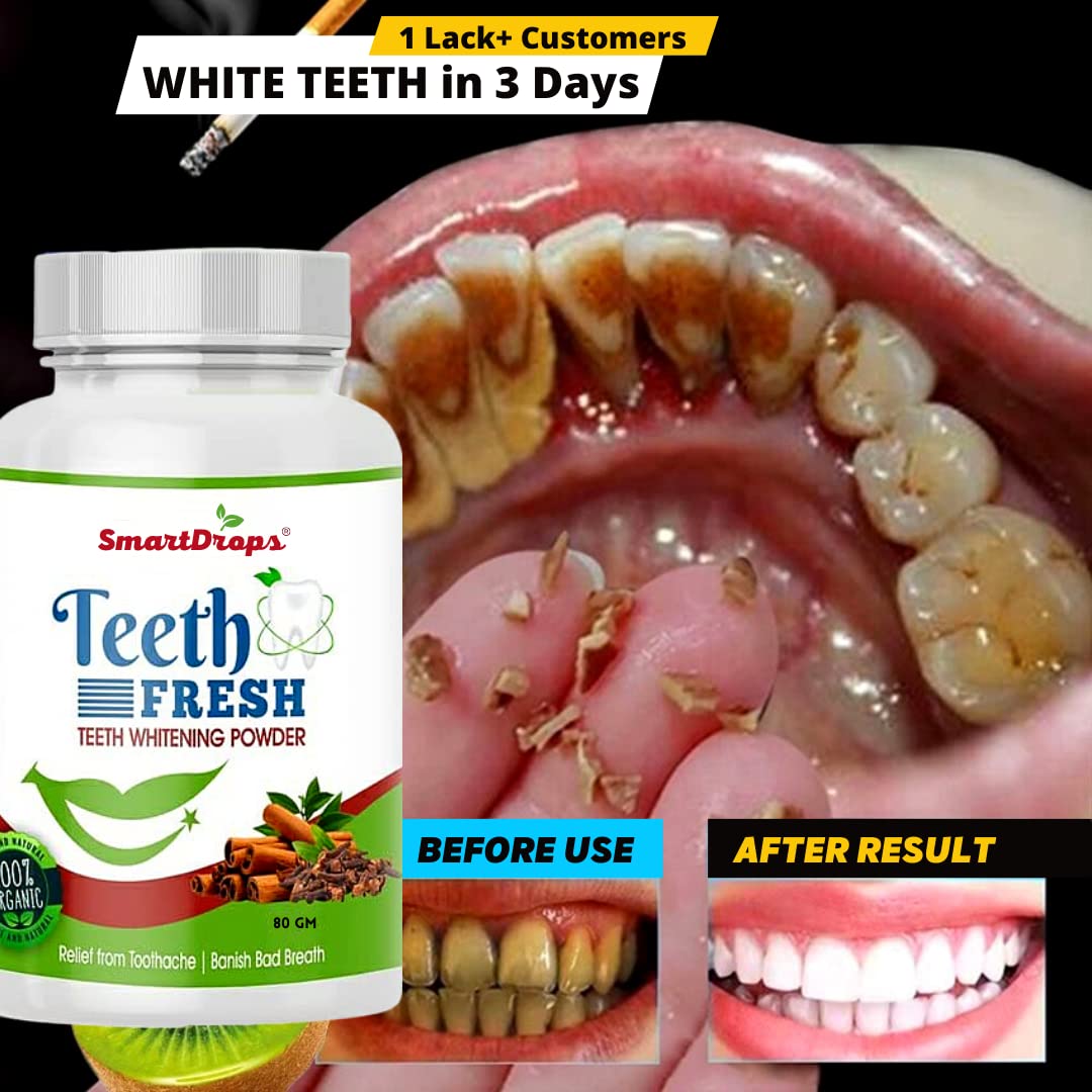 Smartdrops Teeth Whitening Powder, For Shiny Polished Teeth, Improves Teeth Whiteness and Brightness, Helps Fight Plaque, Removes Stains, Freshens Breath, Natural Ingredients, 80gm