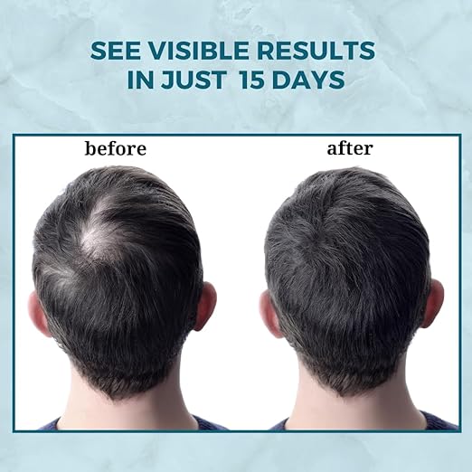 Dokmai London Procapil Hair Growth Serum Concentrate Redensyl Anagain - 50 ml