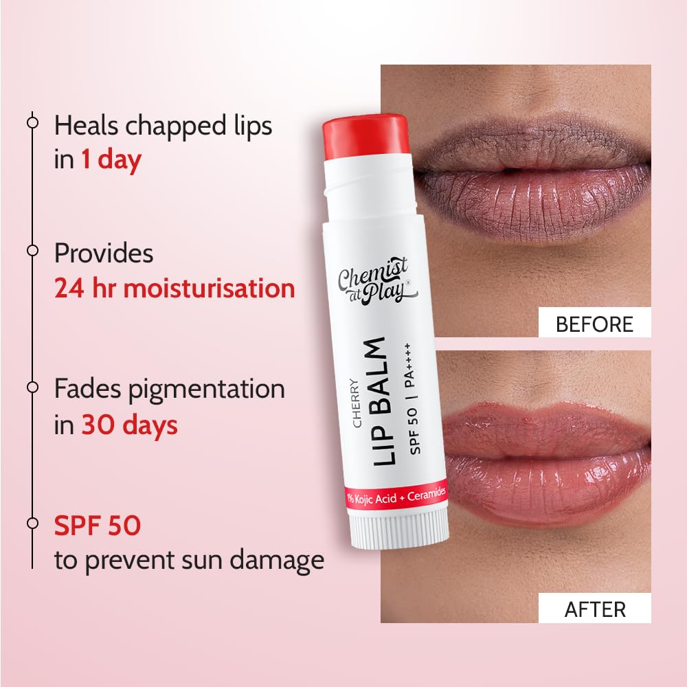 Chemist At Play Tinted Cherry Lip Balm with SPF 50 PA++++ | 1% Kojic Acid | Lip-balm for Dark and Dry Lips | Moisturising Lip Balm for Chapped Lip | Brightens Dark Lips | For Men & Women | 4.5 g