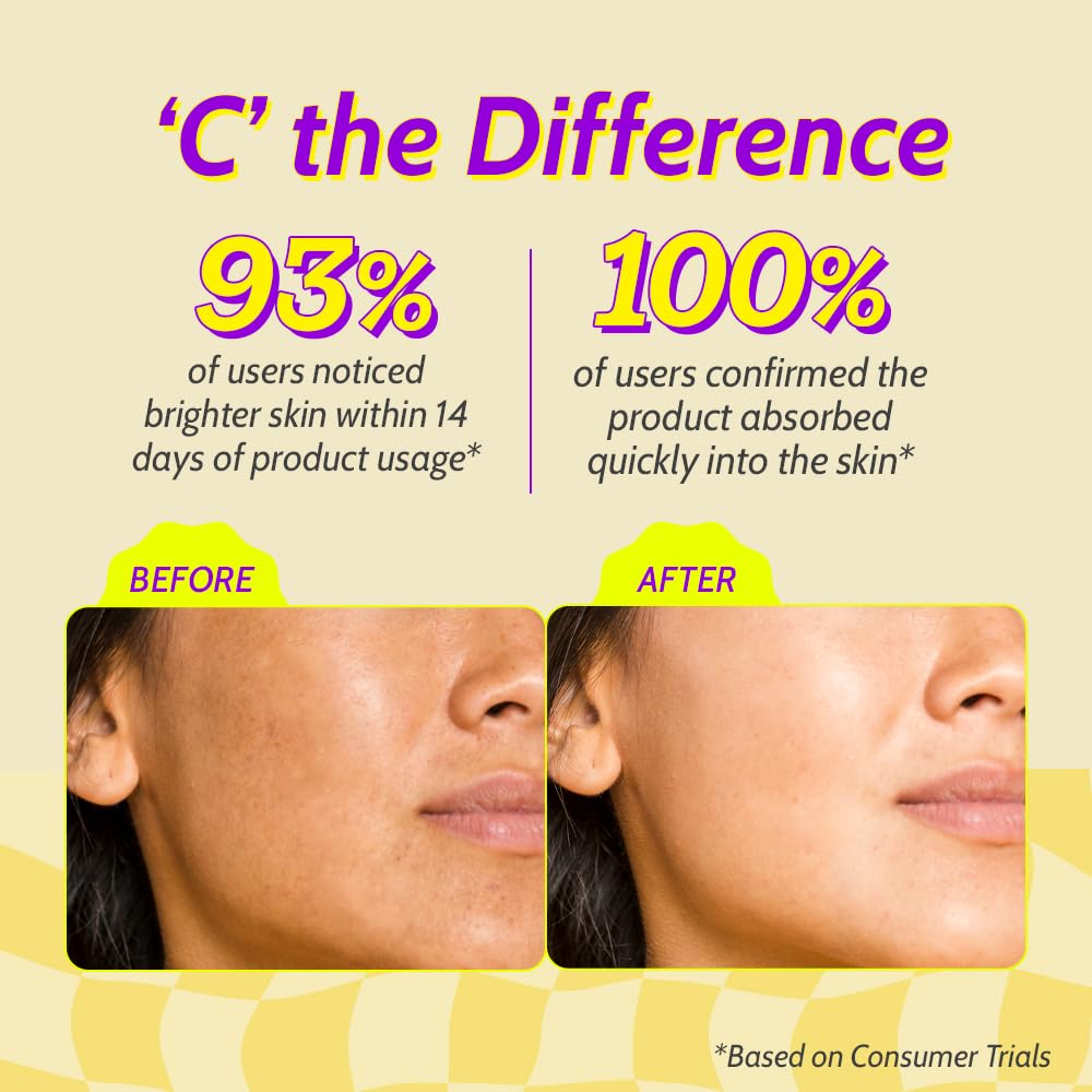 Chemist At Play 10% Vitamin C Serum for Glowing Skin | Pigmentation & Dark Spots | Skin Brightening Face Serum | With Ethyl Ascorbic Acid, Lactic Acid & Glucosamine | For Men & Women | 10 ml