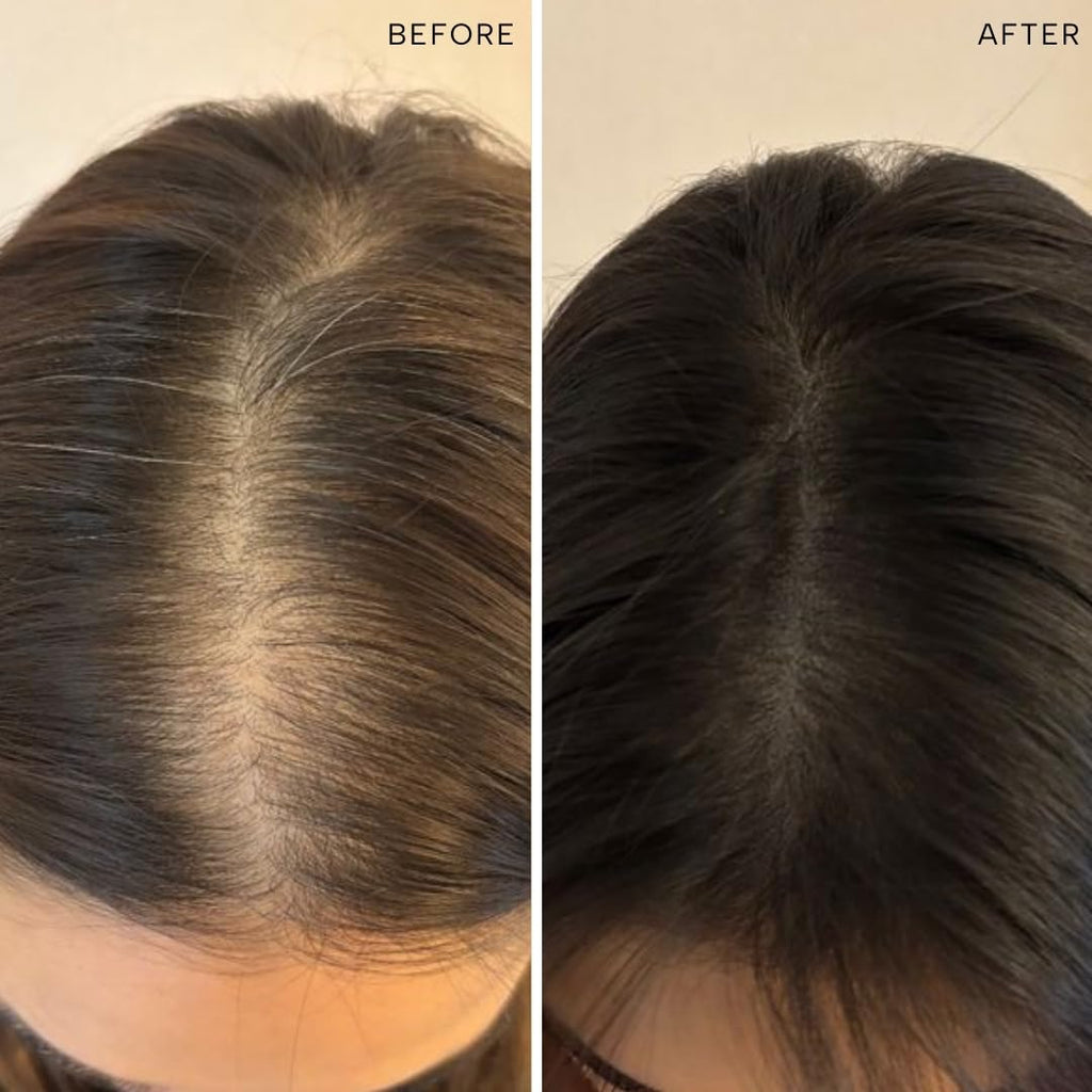 Ras Root-ineâ„¢ Hair Elixir with 30 Regenerative Botanicals