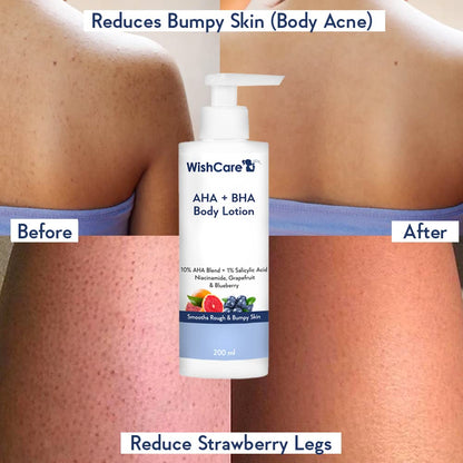 WishCare 10% AHA + 1% BHA Body Lotion - 200 ml