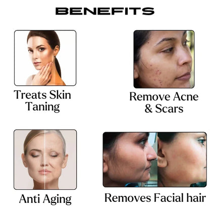Etheric Anti Acne Face Pack – Natural Herbal Skin Clarifying Treatment
