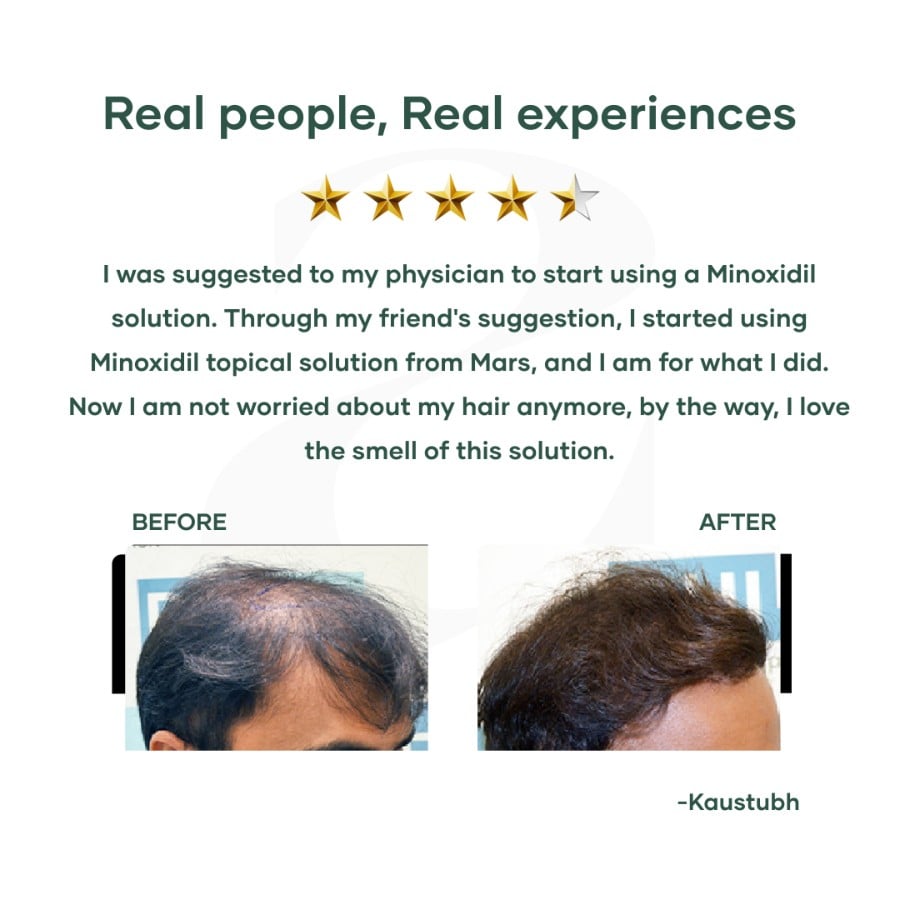 Mars by GHC Minoxi 5% Topical Solution for Hair Regrowth  Best Hair Loss Treatment - 60 ml