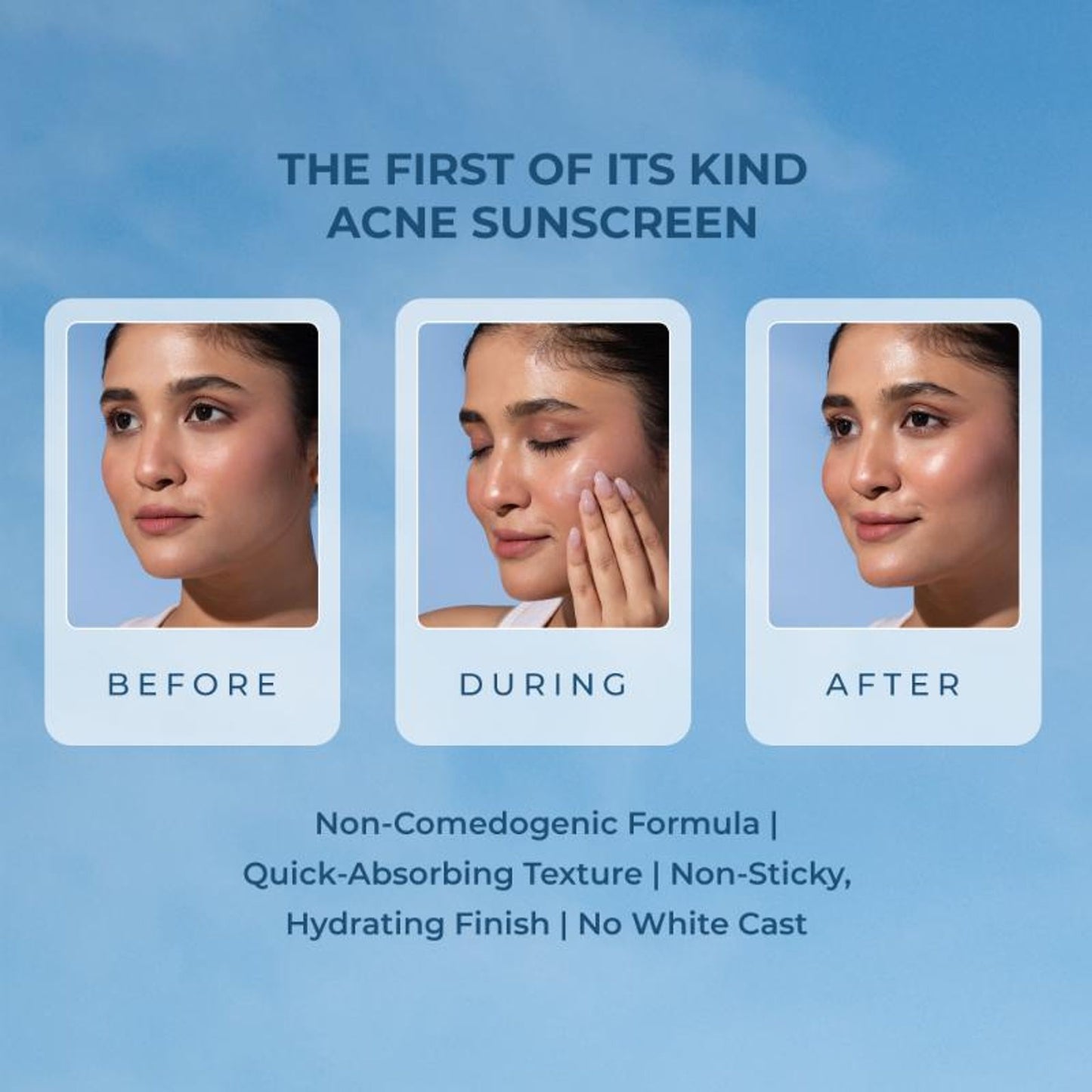 Naturali Acne Control Sunscreen SPF60 With PA+++