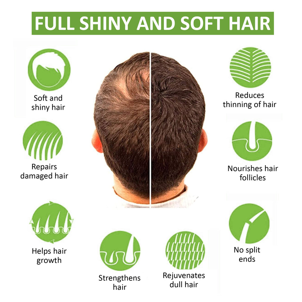 7Days Green Apple Shampoo for Dandruff - 100 ml