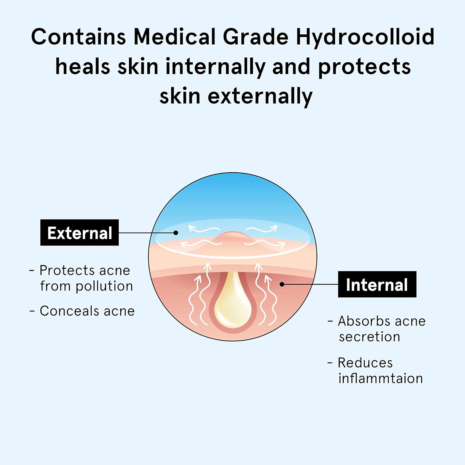 BeBodywise Hydrocolloid Acne Pimple Patch -24 pcs
