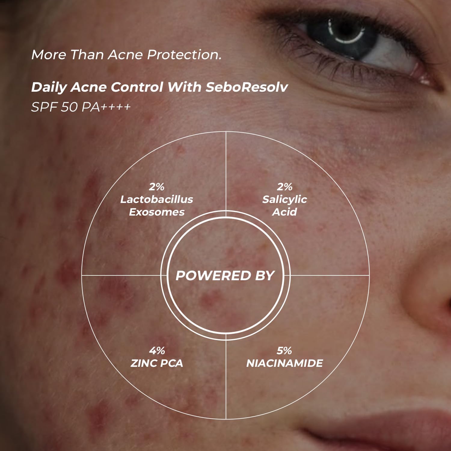 Eclipse Solaire SeboResolv Acne Clarifying SPF 50 PA++++ (UVA, UVB, IR & BR) | No white cast | Non-greasy | Oily/Acne prone skin 60ml