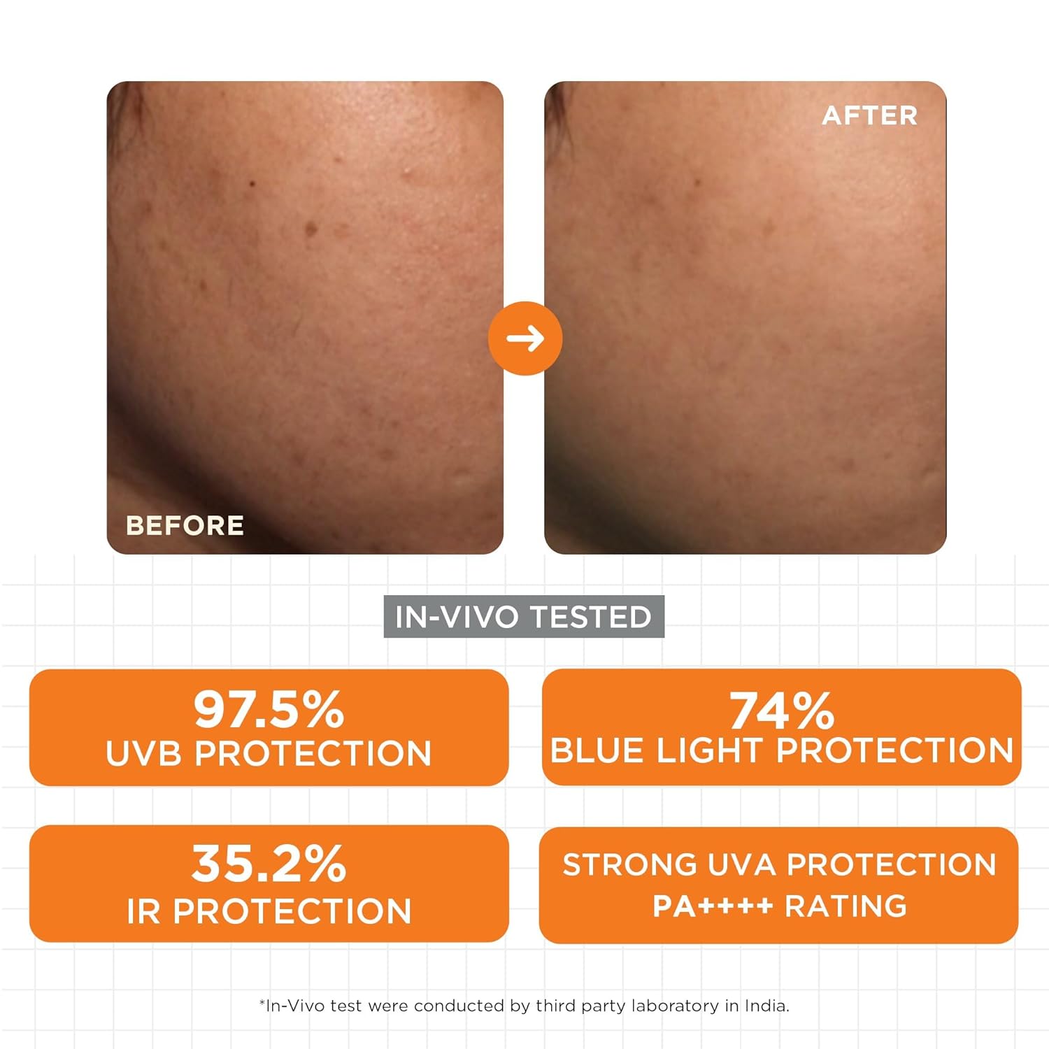 SKINQ Sun Protect Ultra Light Gel Sunscreen SPF 50+ PA++++ with Vitamin C | In-Vivo Tested | Zero White Cast | Lightweight, Non-Greasy | For Dry & Sensitive Skin | Dermat Formulated | 45ml