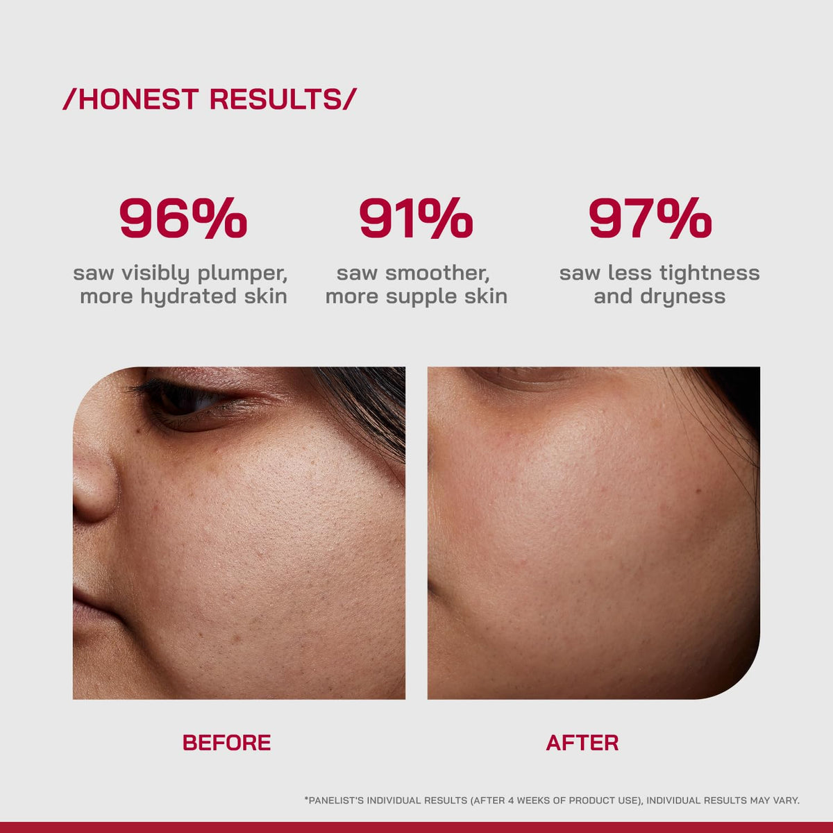 /PHD/ 2% Hyaluronic Acid Dewy Skin Serum | Hyaluronic Acid Face Serum for Dehydrated, Dull & Dry Skin | Hydrating Face Serum with PGA & Panthenol | Deep Hydration & Dewy Finish | Lightweight | 30ml