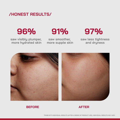 /PHD/ 2% Hyaluronic Acid Dewy Skin Serum | Hyaluronic Acid Face Serum for Dehydrated, Dull & Dry Skin | Hydrating Face Serum with PGA & Panthenol | Deep Hydration & Dewy Finish | Lightweight | 30ml