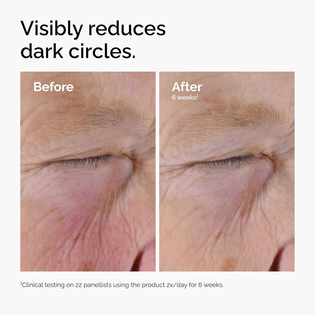 The Ordinary Caffeine Solution 5% + EGCG, Depuffing Eye Serum for Dark Circles and Tired Eyes, 30ml