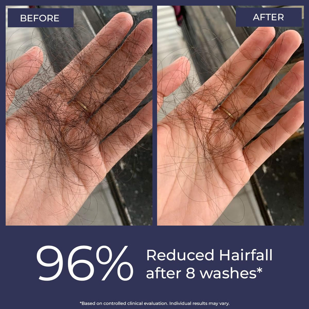 Conscious ChemistÂ® Anti Hairfall Shampoo | Saw palmetto, Yeast Extract, Rosemary OIl & Keratin | 2x Hair Fall Control & Hair Growth | Hard Water Safe | With StrandBoostâ„¢ï¸ Technology | Paraben & SLS Free | For All Hair Types | Women & Men | 200ml