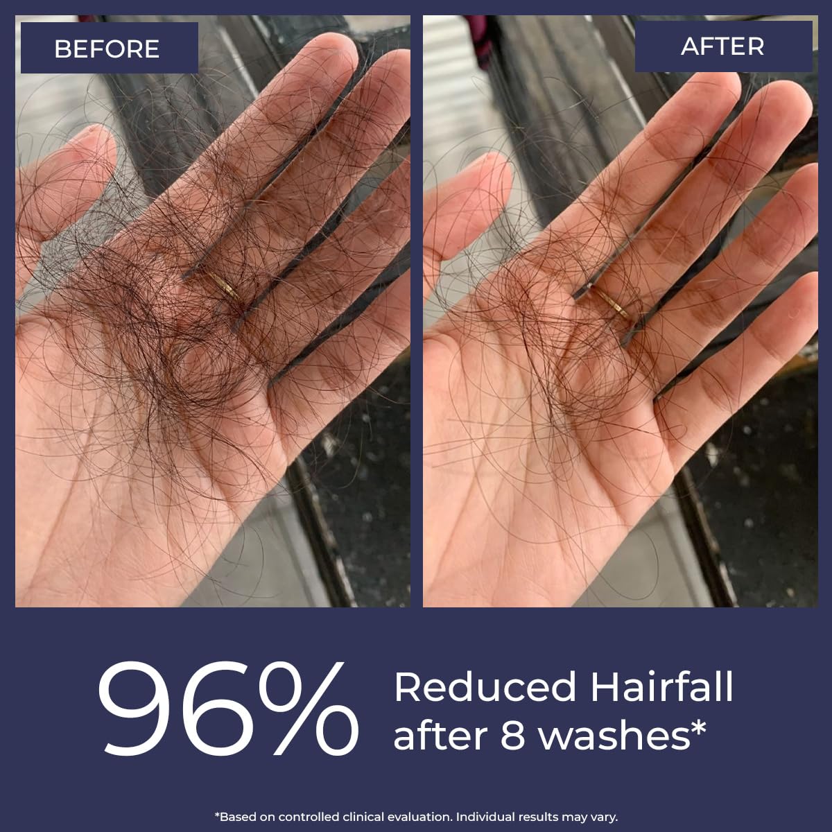 Conscious ChemistÂ® Anti Hairfall Shampoo | Saw palmetto, Yeast Extract, Rosemary OIl & Keratin | 2x Hair Fall Control & Hair Growth | Hard Water Safe | With StrandBoostâ„¢ï¸ Technology | Paraben & SLS Free | For All Hair Types | Women & Men | 200ml