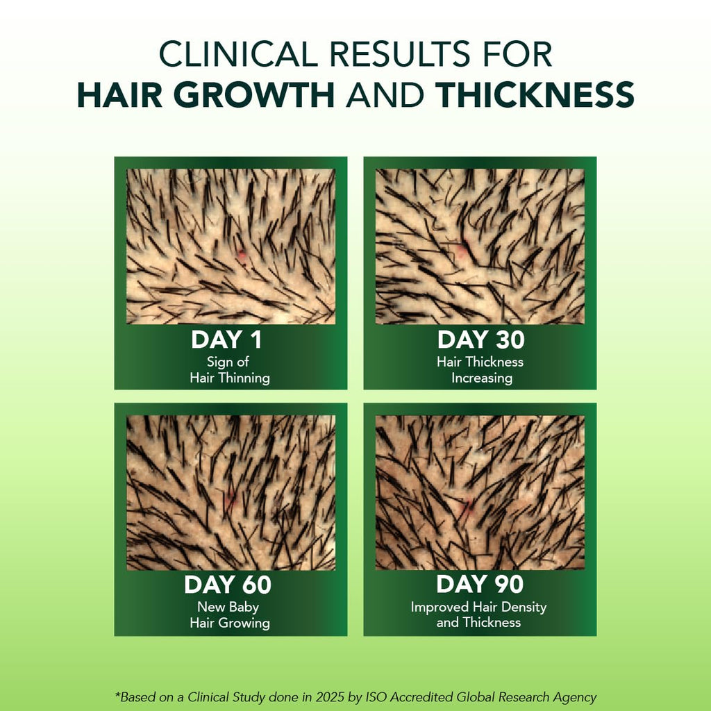 Alps Goodness Rosemary Water Spray for Hair Growth (250ml) | Clinically Proven (In Vivo Tested) to Reduce Hair Fall & Promote Regrowth | 100% Natural Rosemary Extract | Leave-On Scalp & Hair Spray For Men & Women