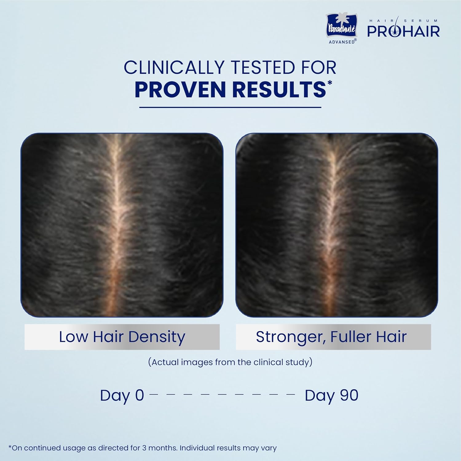 Parachute Advansed Pro Hair Growth Serum for Scalp | With Redensyl, Rosemary, Anagain, Kopexil | Anti Hair fall | Grows New Hair | For Men & Women | 30ml