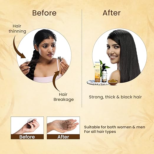 The Skin Story Ayurvedic Hair Growth Oil - 100 ml