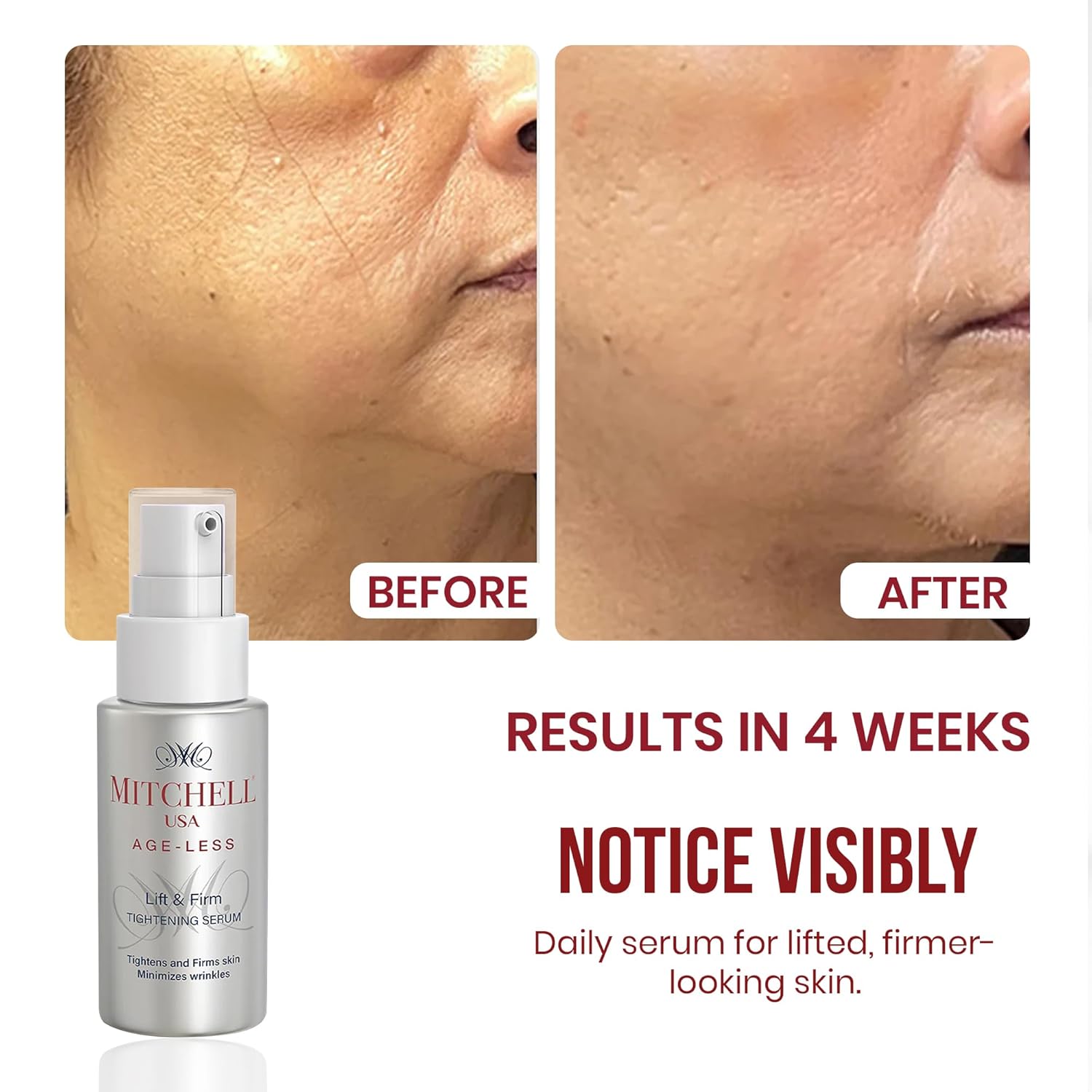 Mitchell USA Lift & Firm Instant Face Tightening and Anti Aging Serum | Targets wrinkles | Helps lift and tighten skin | With Lotus Seed Extract, Hazel Liquid Extract & Vitamin E | For all skin types | 30ml