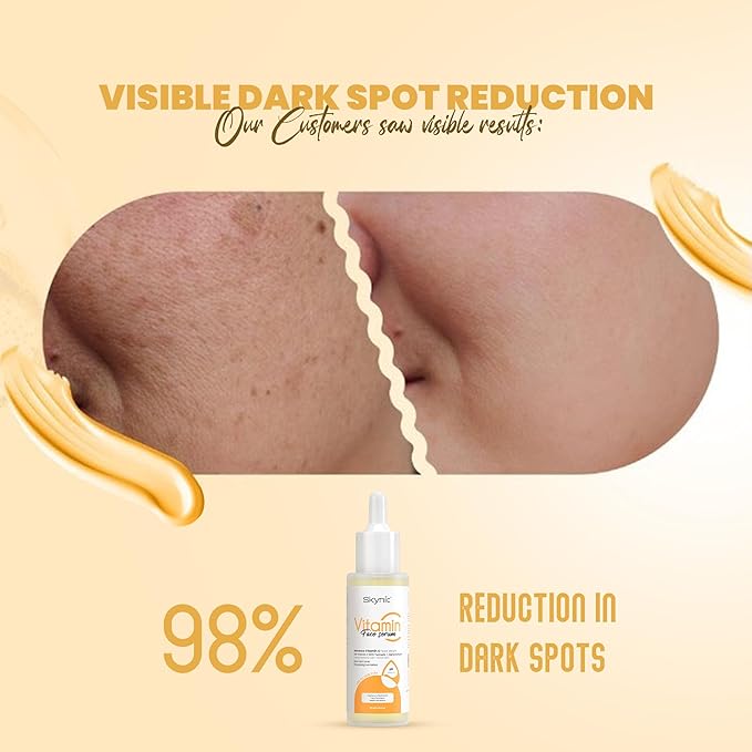 Skynic 10% Vitamin C + E Face Serum - 30 Ml