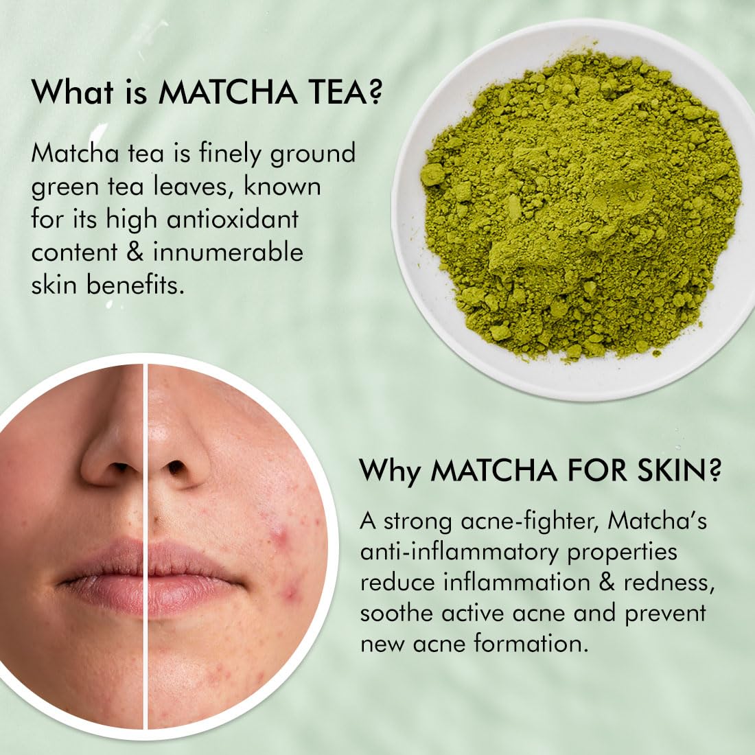 mCaffeine 2% Salicylic Acid Zinc PCA & Matcha Tea Clear Skin Acne Pads | Anti Acne Exfoliating Serum Toner Pads for Acne-Prone Skin | For both Women and Men - 40 N (x1)