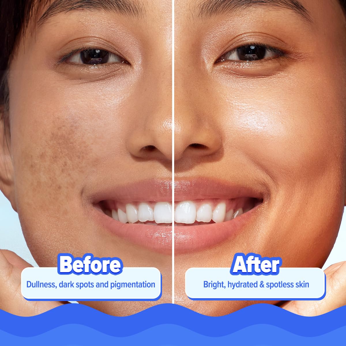 Aqualogica Bright+ Hydra Gel Moisturizer with Blueberry & Kojic Acid - 200 g | 24-Hour Intense Hydration | Water-Like Gel Texture | Makes Skin Bright & Spotless | For All Skin Types
