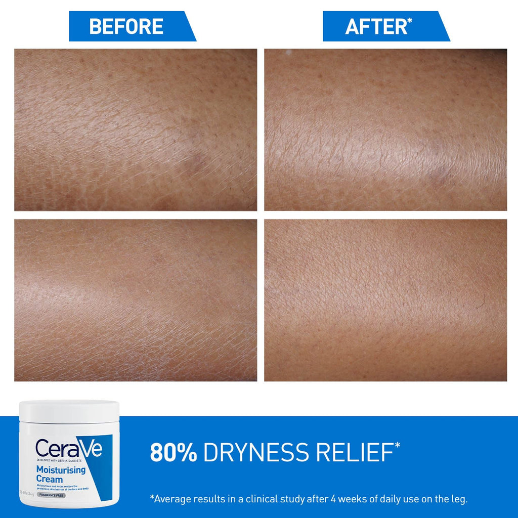 CeraVe Moisturizing Cream For Dry To Very Dry Skin (454g) - Formulated with 3 Essential Ceramides And Hyaluronic Acid | Non-Comedogenic Moisturizer For Face and Body