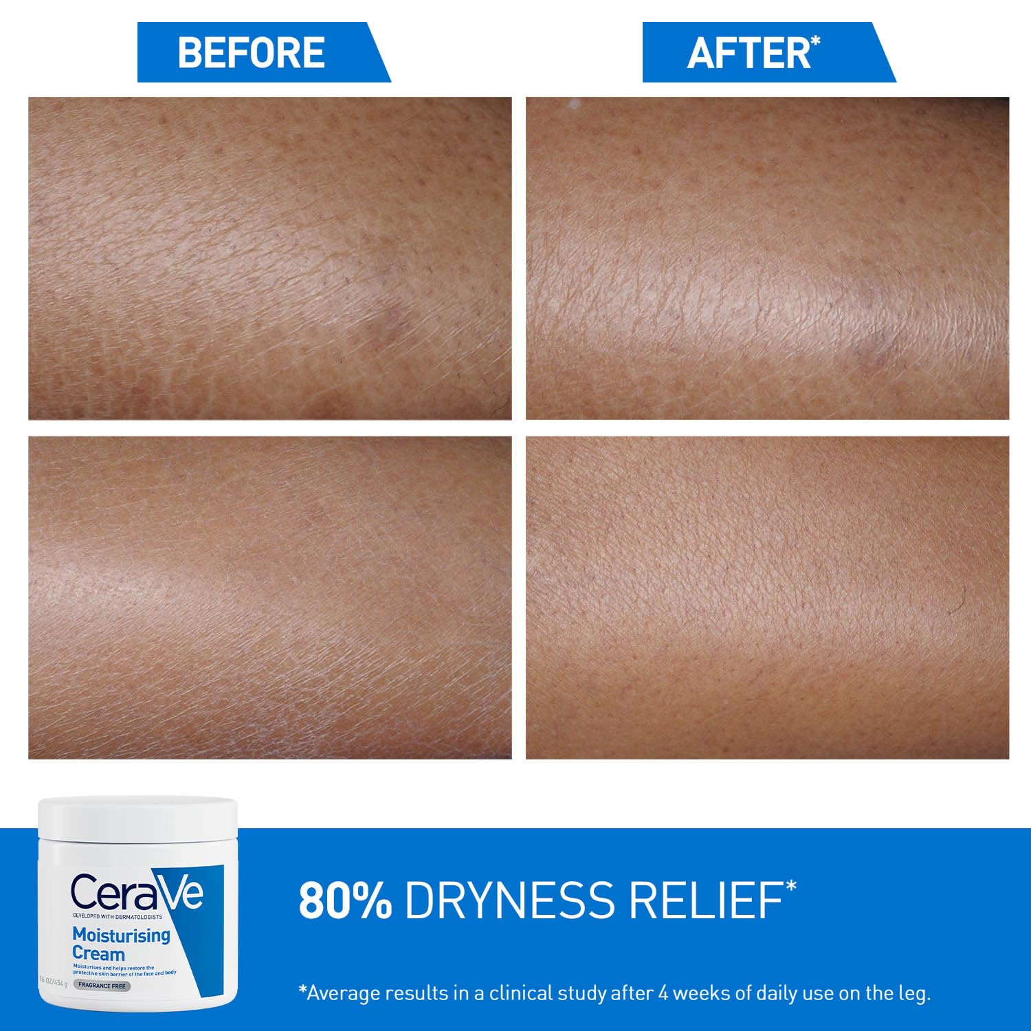 CeraVe Moisturizing Cream For Dry To Very Dry Skin (454g) - Formulated with 3 Essential Ceramides And Hyaluronic Acid | Non-Comedogenic Moisturizer For Face and Body