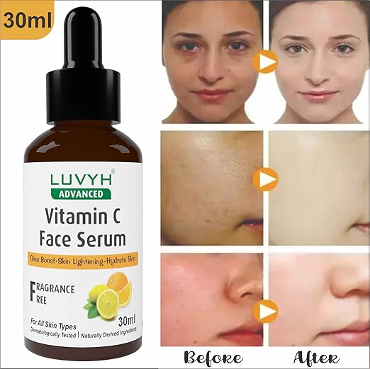 Luvyh Vitamin C Face Serum - 30 ml