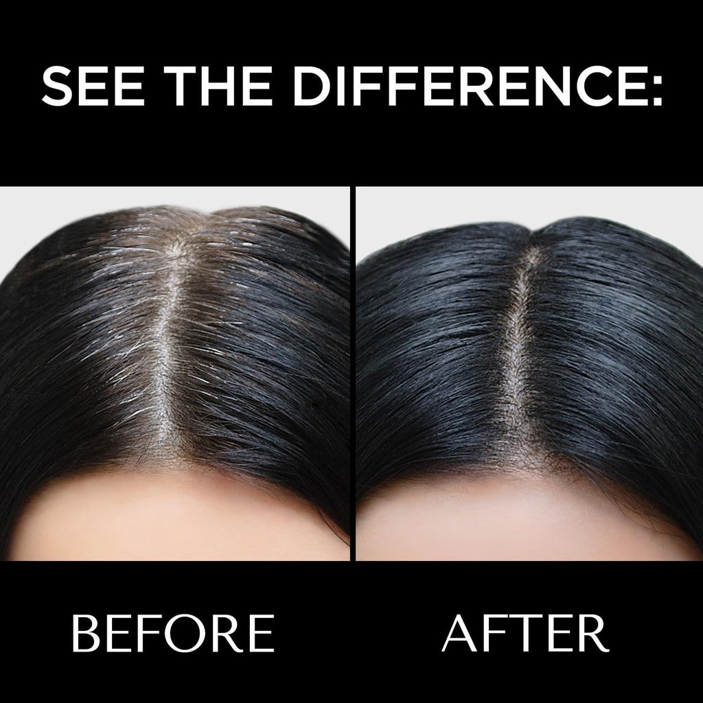 BELLAVITA Black Magic Hair Powder | Covers Grey Hair & Bald Spots Instantly | Root Touch Up | Sweat-Resistant & Long-Lasting Formula | Natural Looking Colour | 4g
