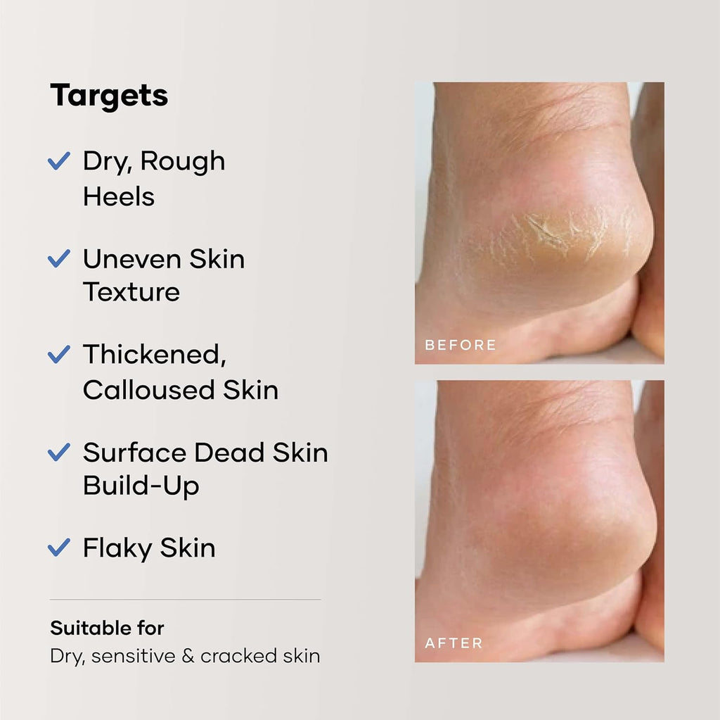 Cureskin Foot Care Cream for Cracked Heels | Repairs, Softens, and Exfoliates | Foot Cream for Women and Men, 50 g (Pack of 1)
