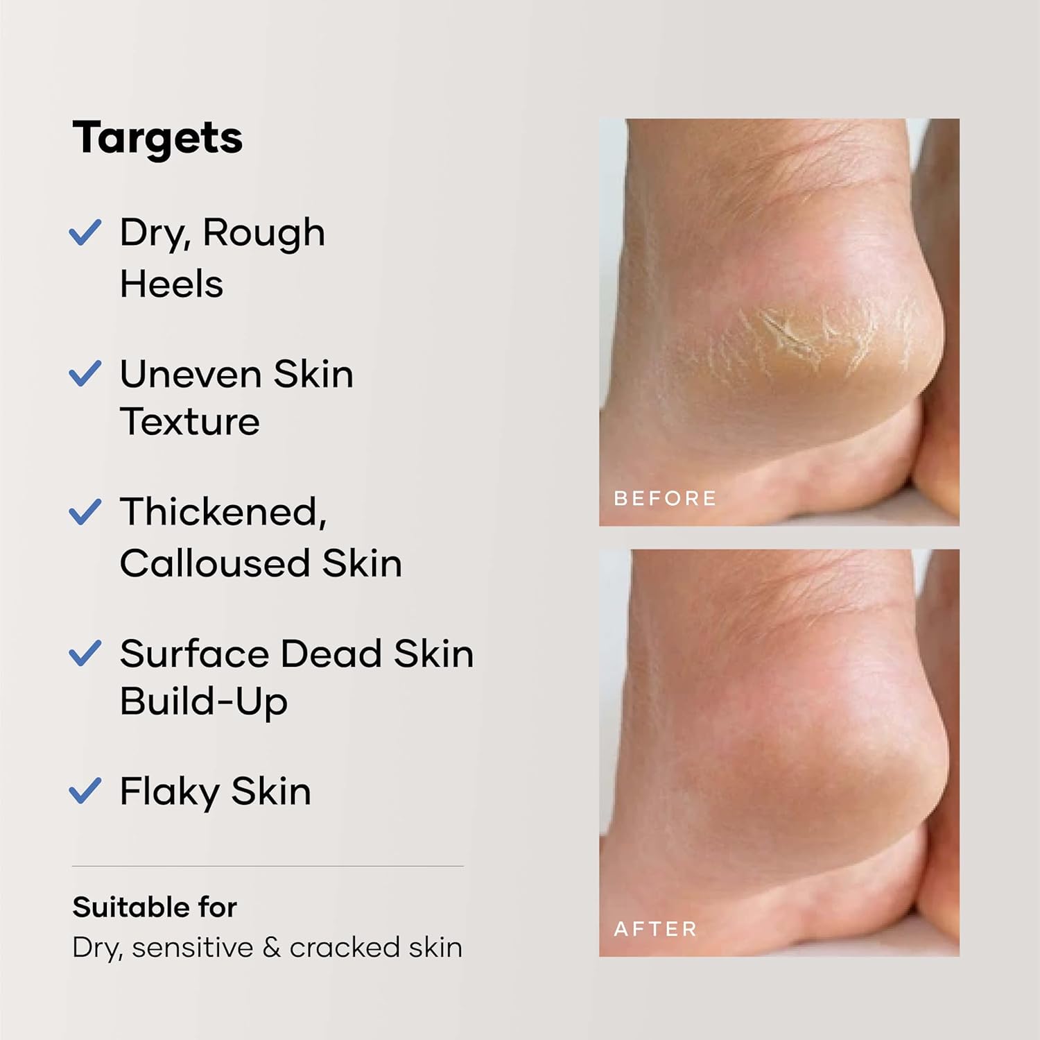 Cureskin Foot Care Cream for Cracked Heels | Repairs, Softens, and Exfoliates | Foot Cream for Women and Men, 50 g (Pack of 1)