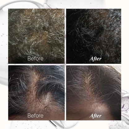 Bontress PRO+ Scalp Serum | Powered by Pro Active Peptides â€“ 5% Capixyl, 3% Redensyl, 3% Anagain, 3% Procapil | Dermat recommended Hair Growth Serum | 94% Users Reported Hair Growth in 28 Days