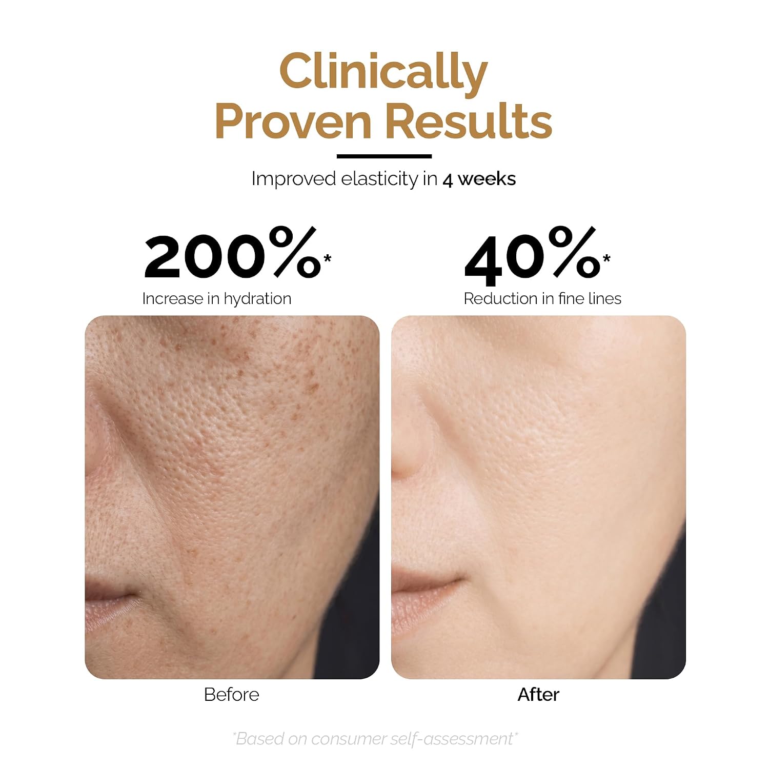 Personal Touch Mucin Moist Serum Cruelty Free - Worldâ€™s 1st Snail Mucin With 9 Types of Hyaluronic Acid, Ceramides, Niacinamide | Korean Skincare | Dryness, Fine Lines, Skin Barrier Repair | 30ml