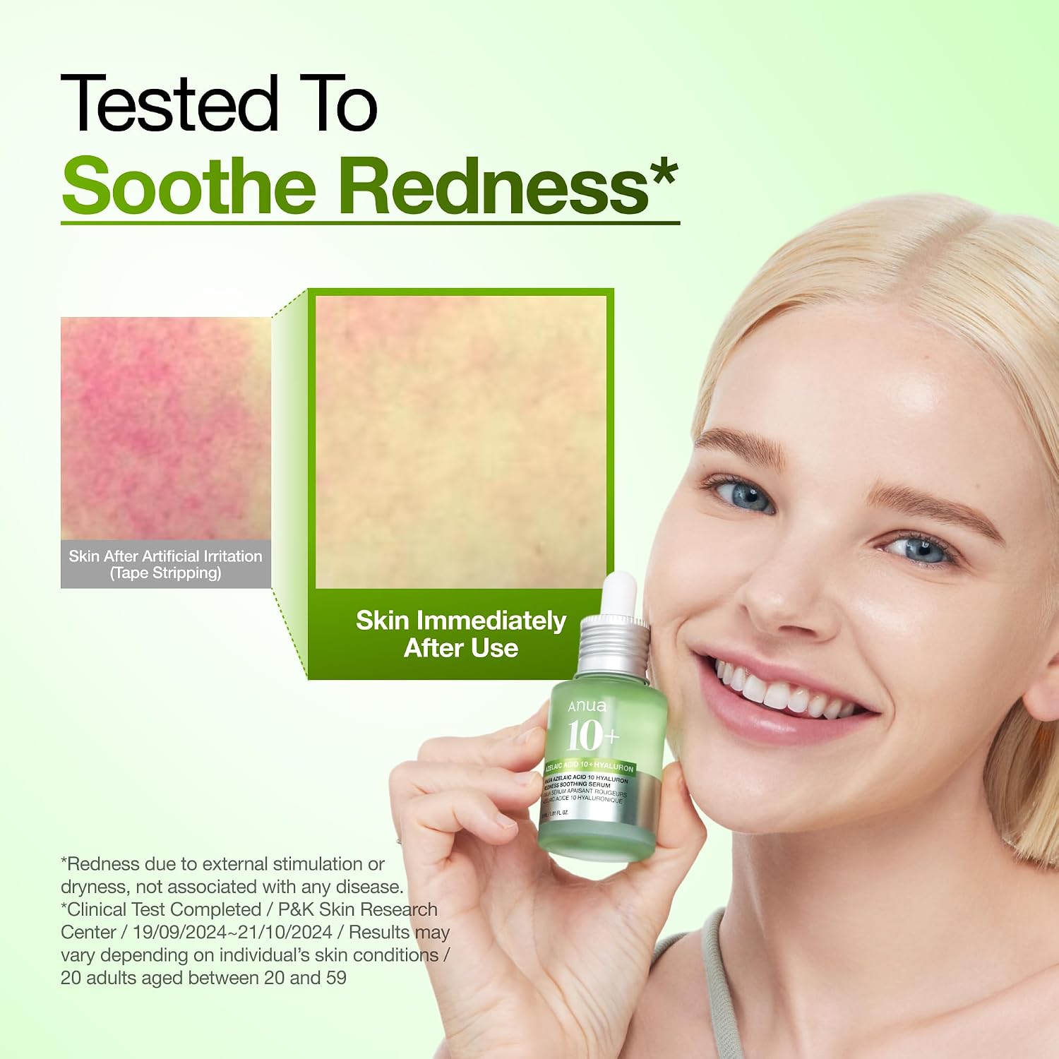 Anua Azelaic Acid 10 Hyaluron Redness Soothing Serum with Cica Soothes & Calms Acne-Prone Skin