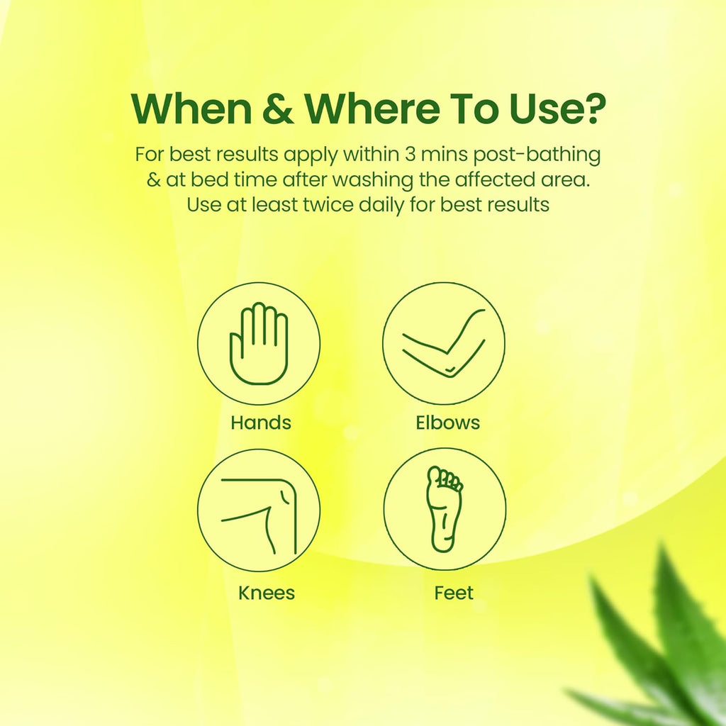 NMFe  150 gm For Intense Moisturisation with Urea 7% & Aloe vera for thick and dry skin | Truly the Healing Moisturiser | For very dry skin | Takes care of cracked heels & Fissure feet effectively