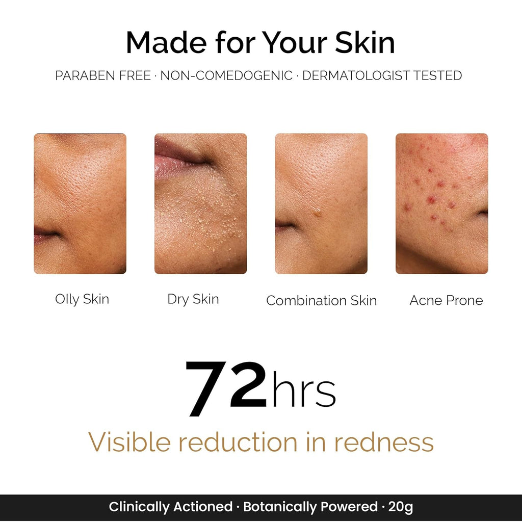 Personal Touch Zitsit Acne Spot Corrector Gel | 2% Salicylic Acid, Niacinamide & Zinc | Spot Corrector for Acne Marks, Dark Spots & Scars | Oil Control for Acne-Prone Skin | 20g