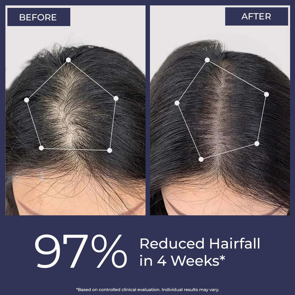 Conscious ChemistÂ® Rosemary Water Spray for Hair Growth | Anti Hair Fall Scalp Spray with Tripeptide-1 & Redensyl | Boosts New Growth & Strengthens Roots | Lightweight Non-Greasy Hair Mist | For All Hair Types | Women & Men | 200ml