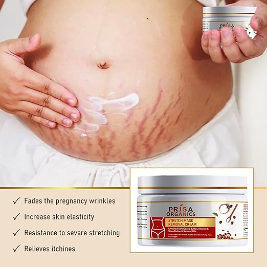 Prisa Organics Stretch Mark Cream for Pregnancy - 100 gms