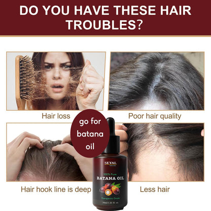 Seyal 100% Pure Batana Oil for Hair Growth