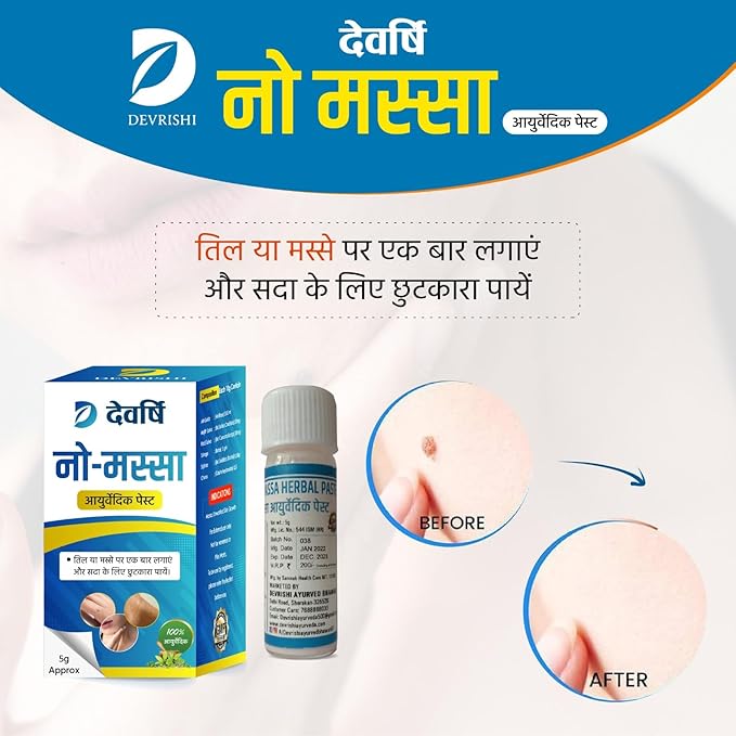 Devrishi Wart Remover Ointment Cream - 5 gms