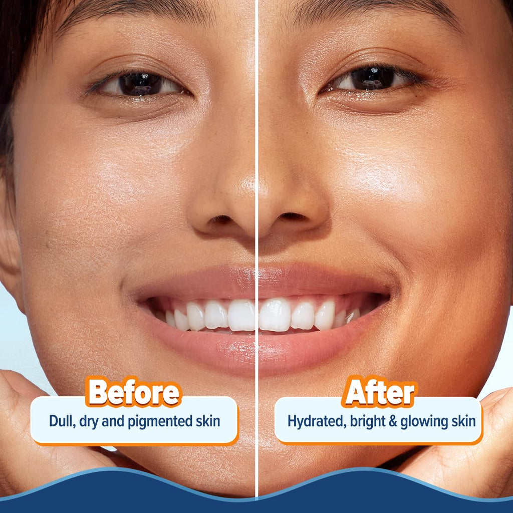 Aqualogica Glow+ Hydra Gel Moisturizer with Vitamin C & Papaya - 100 g|24-Hour Intense Hydration|Weightless Water-Like Gel Texture|Non Sticky & Quick Absorbing for Glowing Skin